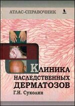Клиника наследственных дерматозов. Атлас-справочник
