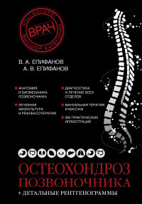 Остеохондроз позвоночника