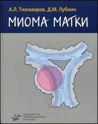 Миома матки