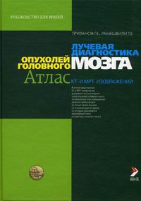 Лучевая диагностика опухолей головного мозга Атлас КТ и МРТ-изображений