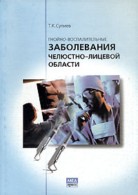Гнойно-воспалительные заболевания челюстно-лицевой области