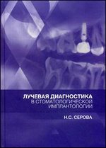 Лучевая диагностика в стоматологической имплантологии