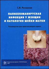 Папилломавирусная инфекция у женщин и патология шейки матки